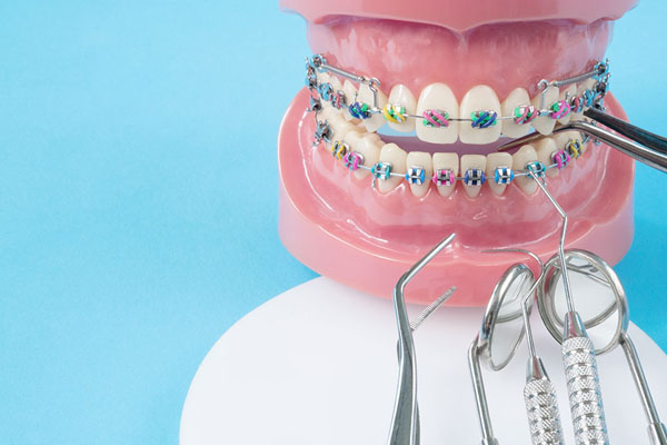 braces on fake teeth surrounded by dental tools